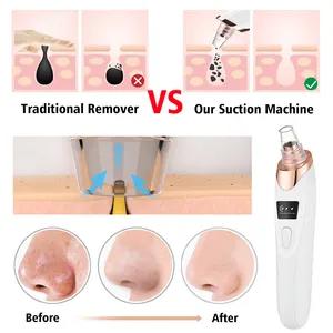 KKS beauti products facial lift rechargeable electric pimple ance pore cleaner vacuum blackhead remover